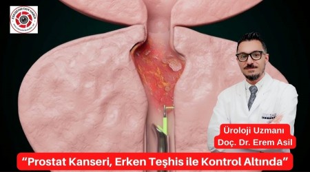 Prostat Kanseri, Erken Tehis ile Kontrol Altnda