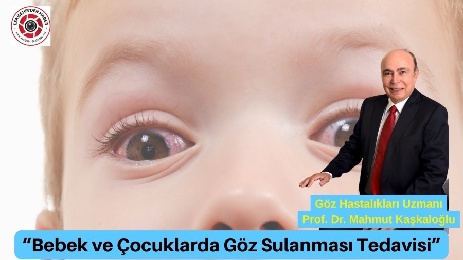Bebek ve ocuklarda Gz Sulanmas Tedavisi