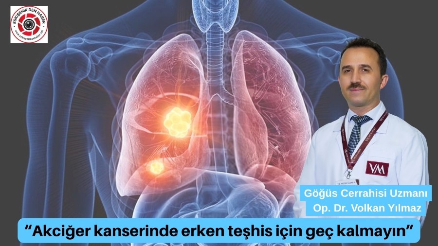 Op. Dr. Volkan Ylmaz, Akcier kanserinde erken tehis iin ge kalmayn 