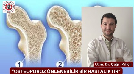 OSTEOPOROZ NLENEBLR BR HASTALIKTIR